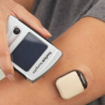 Monitores de azúcar en la sangre para los diabéticos tipo 1