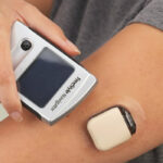 La Sociedad de Endocrinología recomienda el uso del CGM para los pacientes con diabetes tipo 1