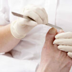 Problemas en los pies causados por la diabetes