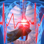 Nuevo fármaco podría reducir el riesgo de ataque al corazón en los diabéticos tipo 1