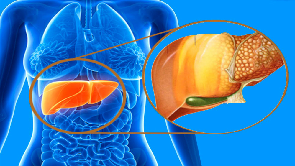 Las investigaciones vinculan la enfermedad del hígado graso a la diabetes tipo 2