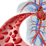 La hipoglucemia en la diabetes tipo 2 podría afectar a la salud del corazón