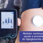 Monitor de glucosa en tiempo real ayuda a las personas a prevenir episodios severos de hipoglucemia asintomática