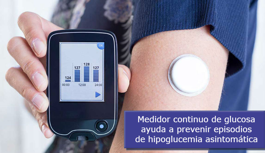 Monitor de glucosa en tiempo real ayuda a las personas a prevenir episodios severos de hipoglucemia asintomática