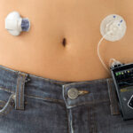 La FDA aprueba el primer sistema automatizado de insulina para la diabetes tipo 1