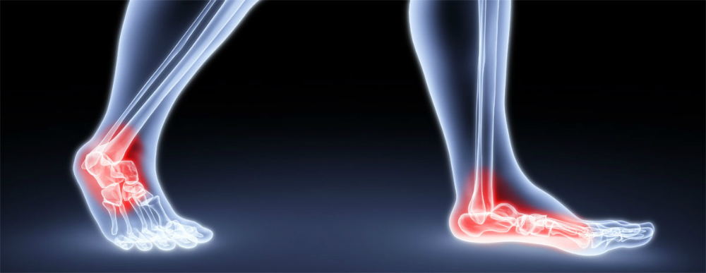 Programa de ejercicios mejora el equilibrio y la fuerza física en los pacientes con diabetes tipo 2 y neuropatía periférica