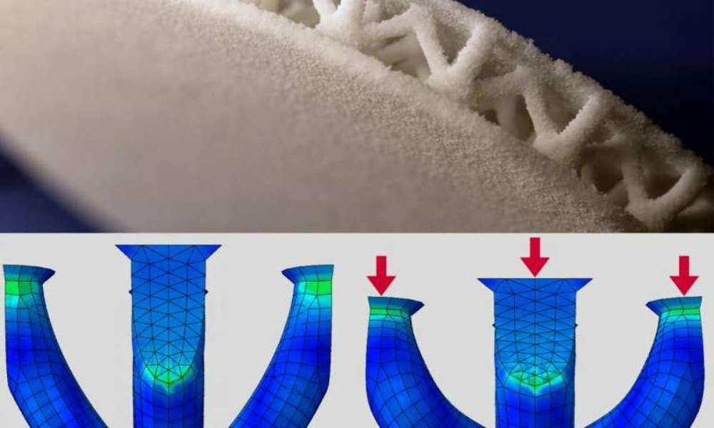 Plantillas impresas en 3-D hechas a la medida para los pacientes con diabetes