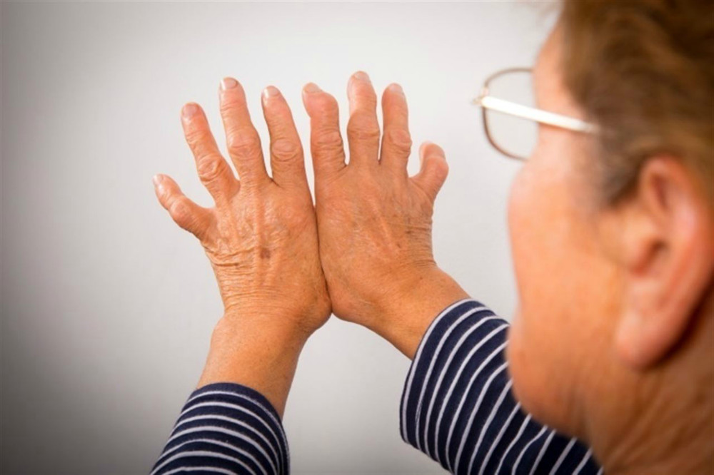 ¿Cómo la artritis psoriásica puede afectar el riesgo de desarrollar diabetes?