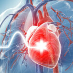 Las sulfonilureas y el riesgo de eventos cardiovasculares e hipoglucemia