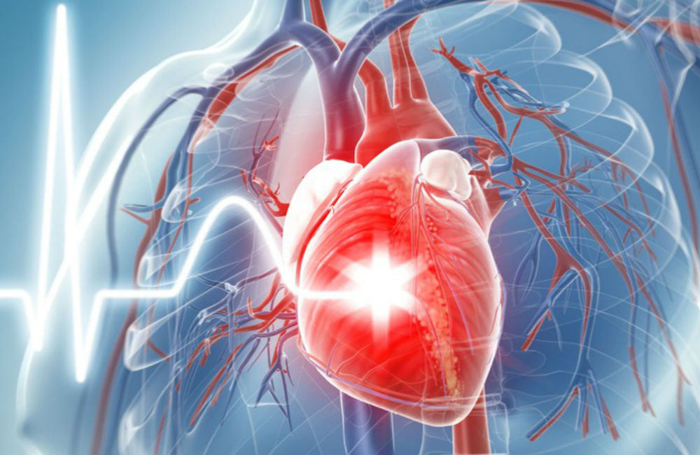 Las sulfonilureas y el riesgo de eventos cardiovasculares e hipoglucemia