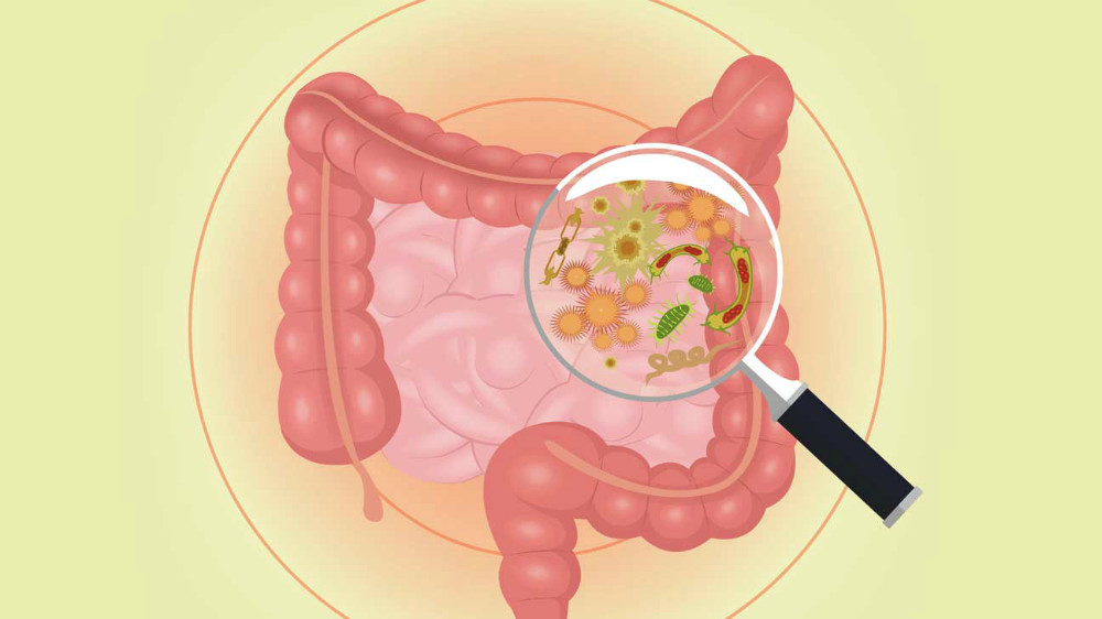 El estudio del microbioma en la Clínica de Mayo se dirige a la diabetes