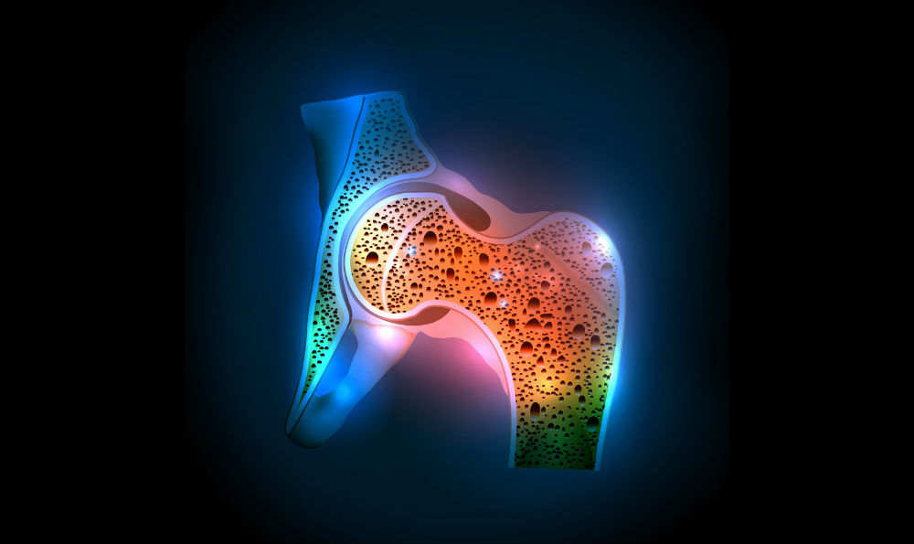 La osteoporosis y la diabetes: pros y contras de los regímenes antidiabéticos