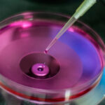 Pacientes con diabetes dan una oportunidad al tratamiento de células madre